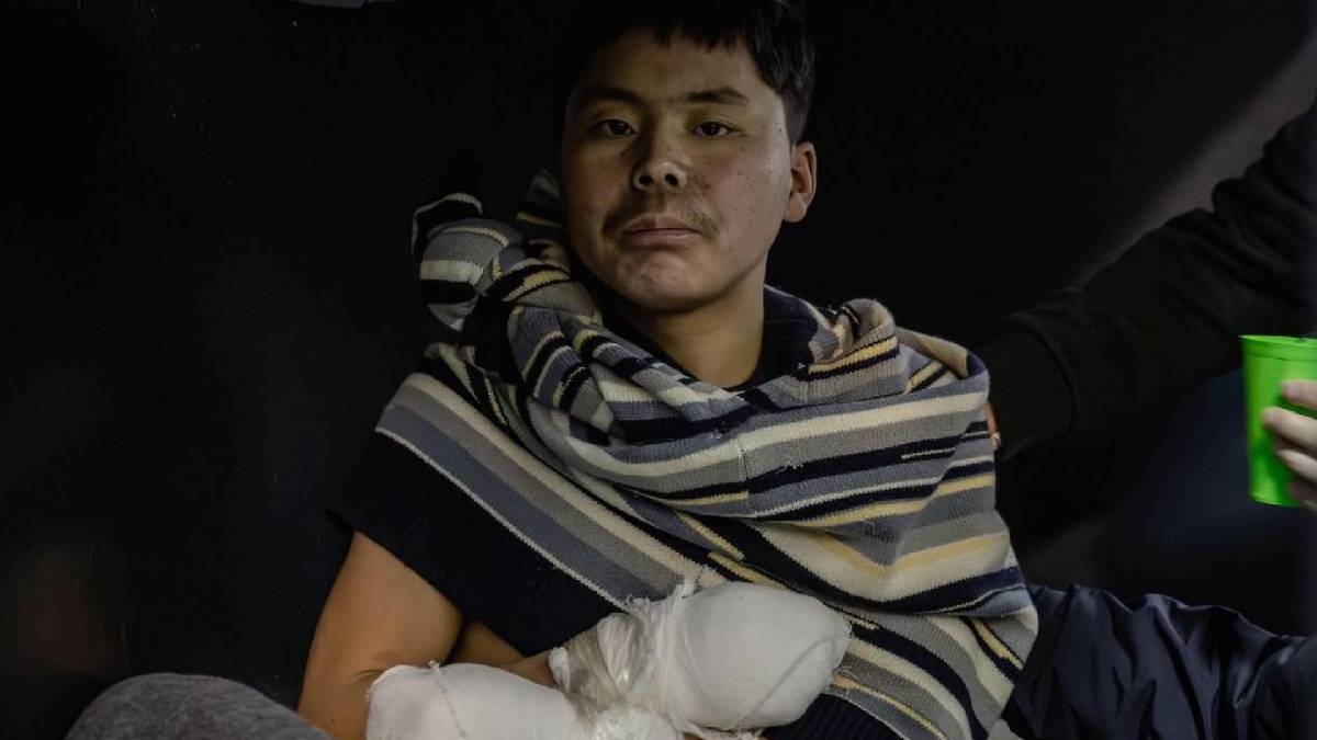 Получили тяжелые ранения: Зеленский рассказал о пленных солдатах КНДР